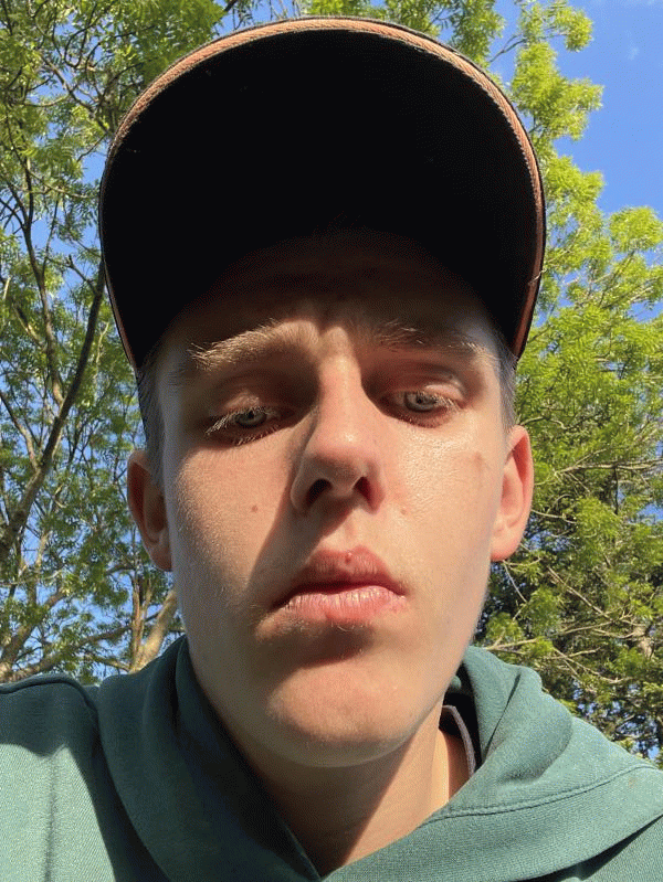 Christophe Caux 19 ans Callengeville